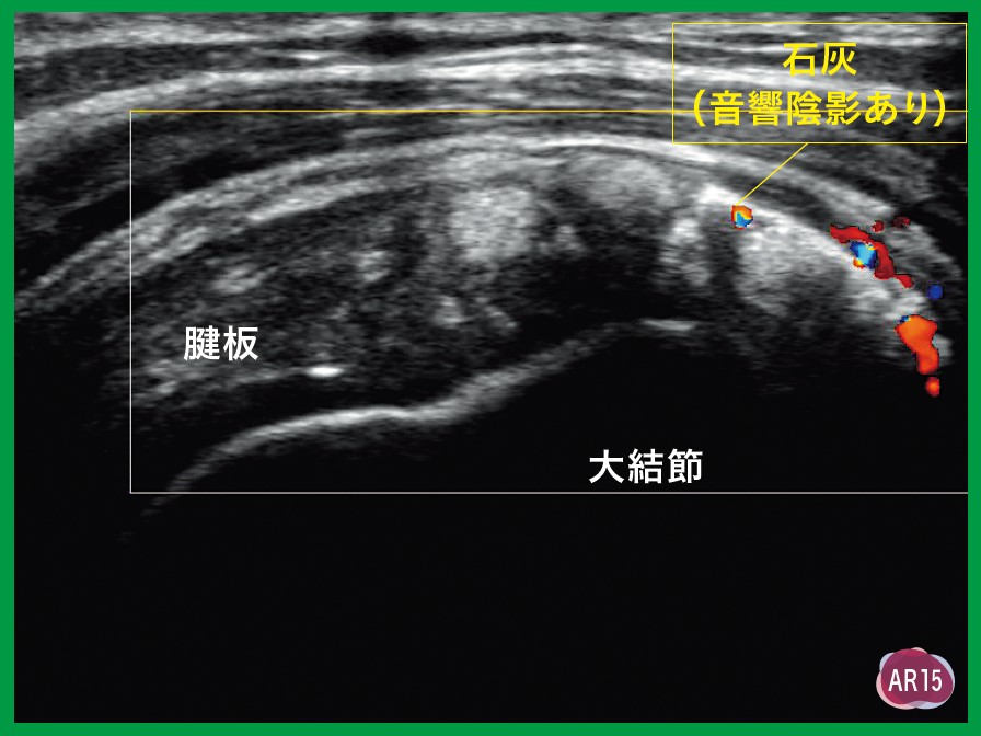 運動器エコーのメタ診療｜動画ライブラリ