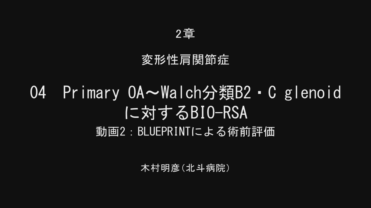 人工肩関節置換術 HHR・TSA・RSA｜動画ライブラリ