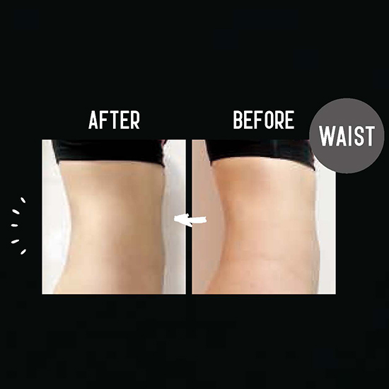 優待価格[Chino THE METHOD]ファシア アミノジスト ローション