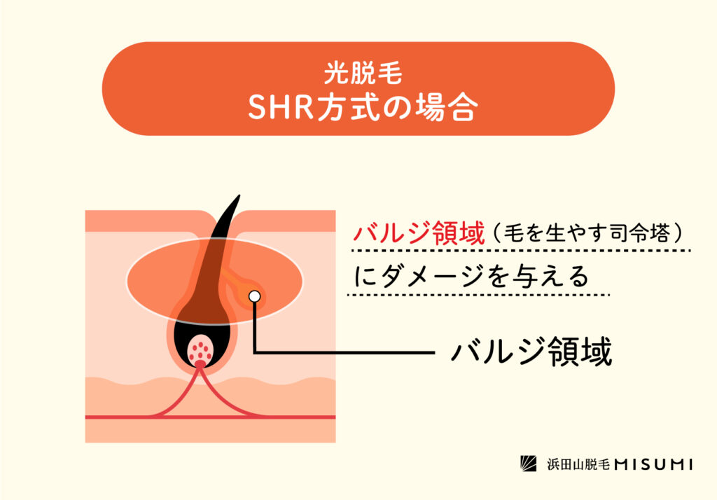 白髪は脱毛できない？その理由と脱毛の仕組みとは – 浜田山脱毛MISUMI