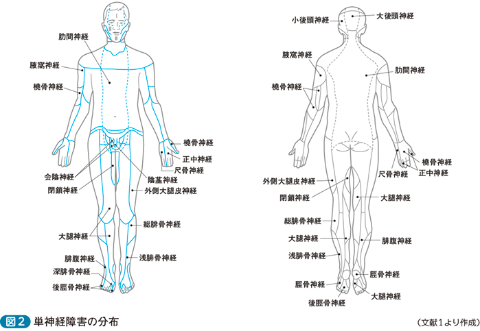 神経障害性疼痛─解剖学的アプローチ［直感で始める診断推論（5