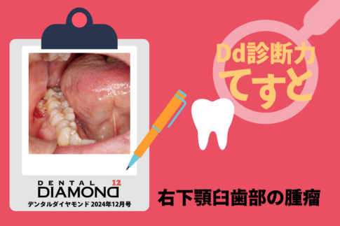 刊行にあたって：舌骨から紐解く顎機能の謎 丸茂義二のファイナル