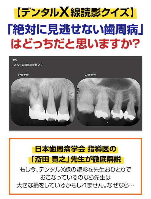 株式会社 医療情報研究所 | ペリオ特化型 歯科衛生士即戦力プログラム
