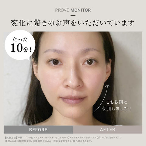 dショッピング |最先端 EMS 美顔器 ※目元・口元の変化 速攻実感