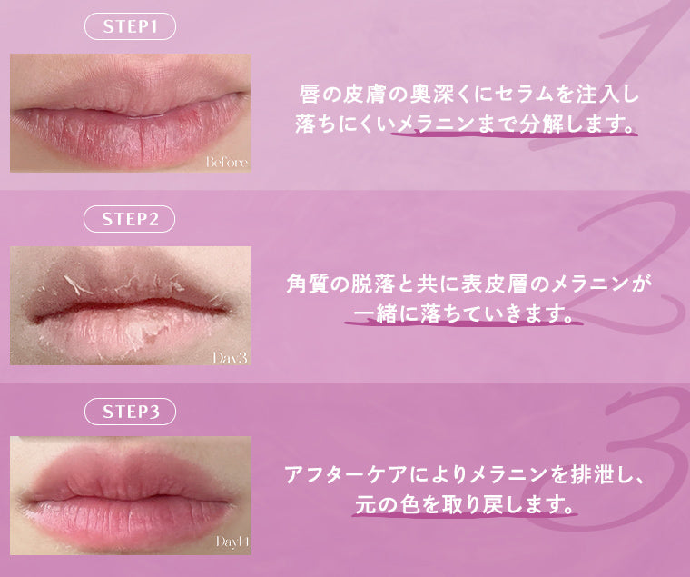 Roma Pink アフタークリーム リップ用 ピンク 3個セット ローマピンク