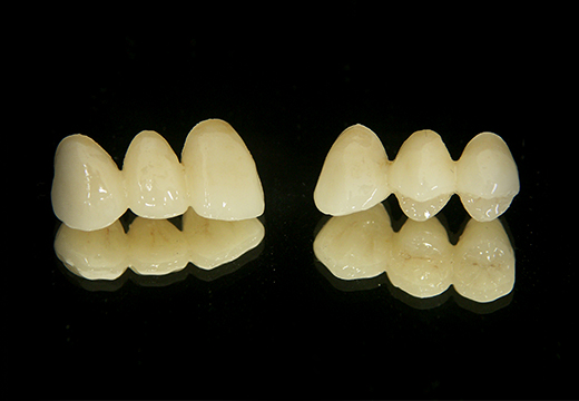 審美補綴｜株式会社 六甲歯研