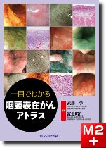 m3電子書籍 | こんなときどうする!? 食道癌・咽頭癌 内視鏡の達人たち