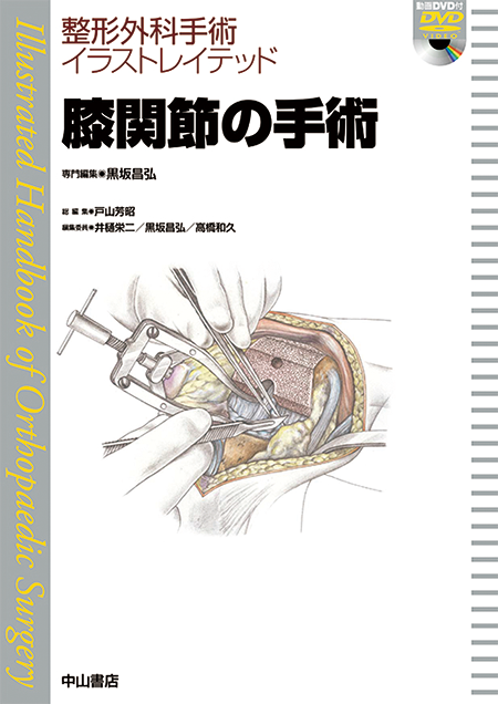 m3電子書籍 | 整形外科手術イラストレイテッド膝関節の手術［動画付き］