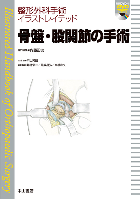 m3電子書籍 | 整形外科手術イラストレイテッド骨盤・股関節の手術