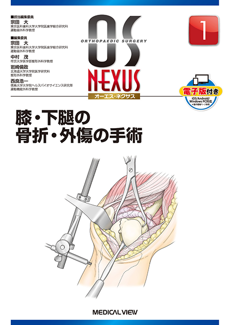 m3電子書籍 | 新OS NEXUS No.4 下肢の骨折手術1 骨盤・大腿骨