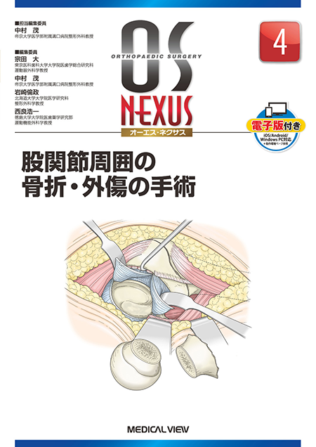 m3電子書籍 | 新OS NEXUS No.3 ベーシックな脊椎除圧術のすべて