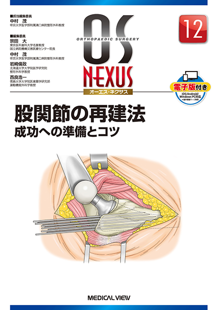 m3電子書籍 | 新OS NEXUS No.10 股・膝関節の鏡視下手術［Web動画付］