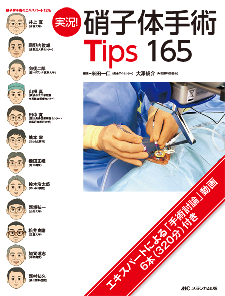 m3電子書籍 | ④最新 弱視・斜視診療エキスパートガイド―解剖生理