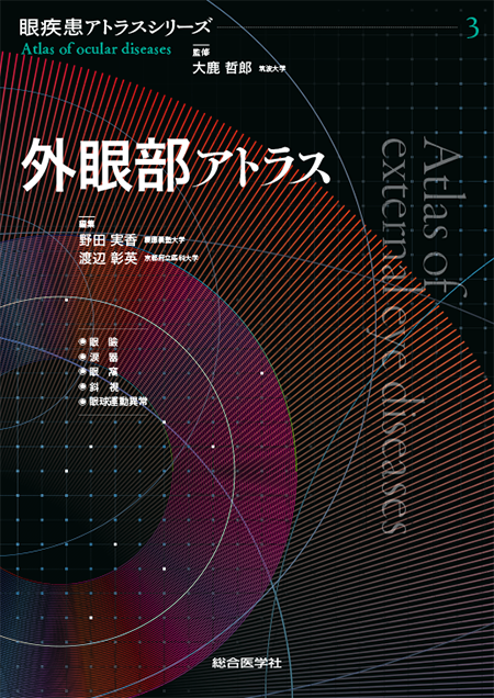 m3電子書籍 | 眼疾患アトラスシリーズ 第3巻 外眼部アトラス