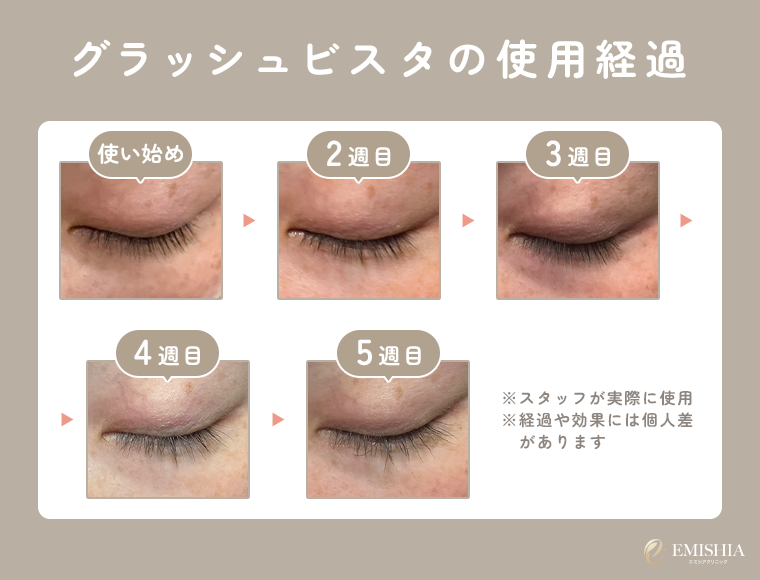 グラッシュビスタ美容液の効果や副作用を医師が解説！クリニックでの
