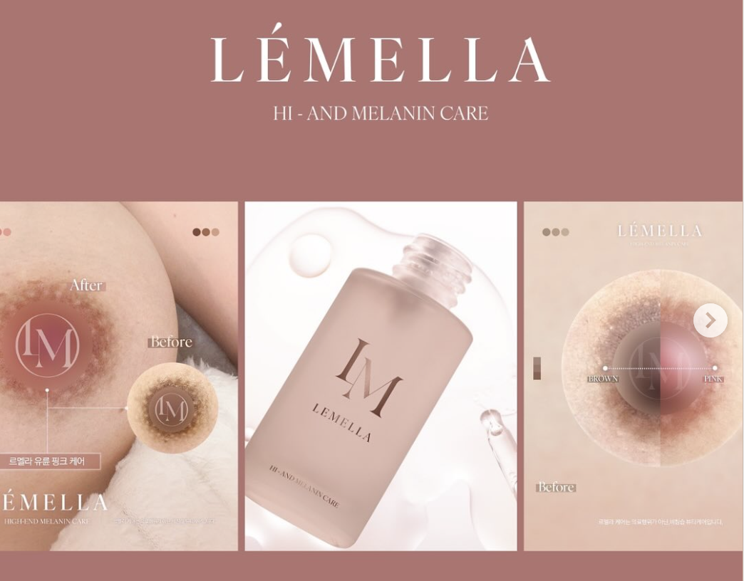 最新の色素沈着ケア｜ルメラの効果・口コミ、料金、施術の流れを徹底