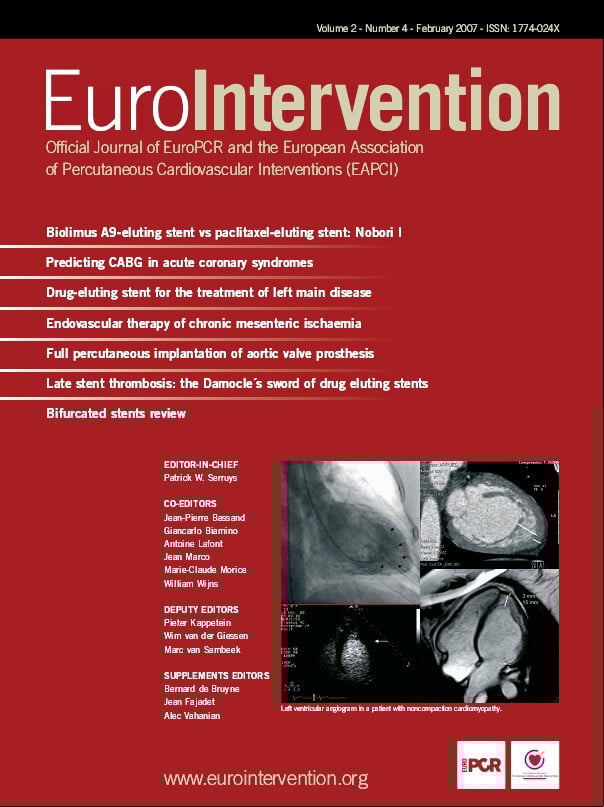 Handbook of Drug-Eluting Stents 英語版 Handbook of Drug-Eluting