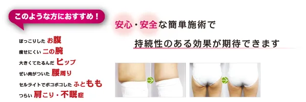 キャビポット（本体/備品） | 業務用美容・エステ機器の卸・仕入通販は