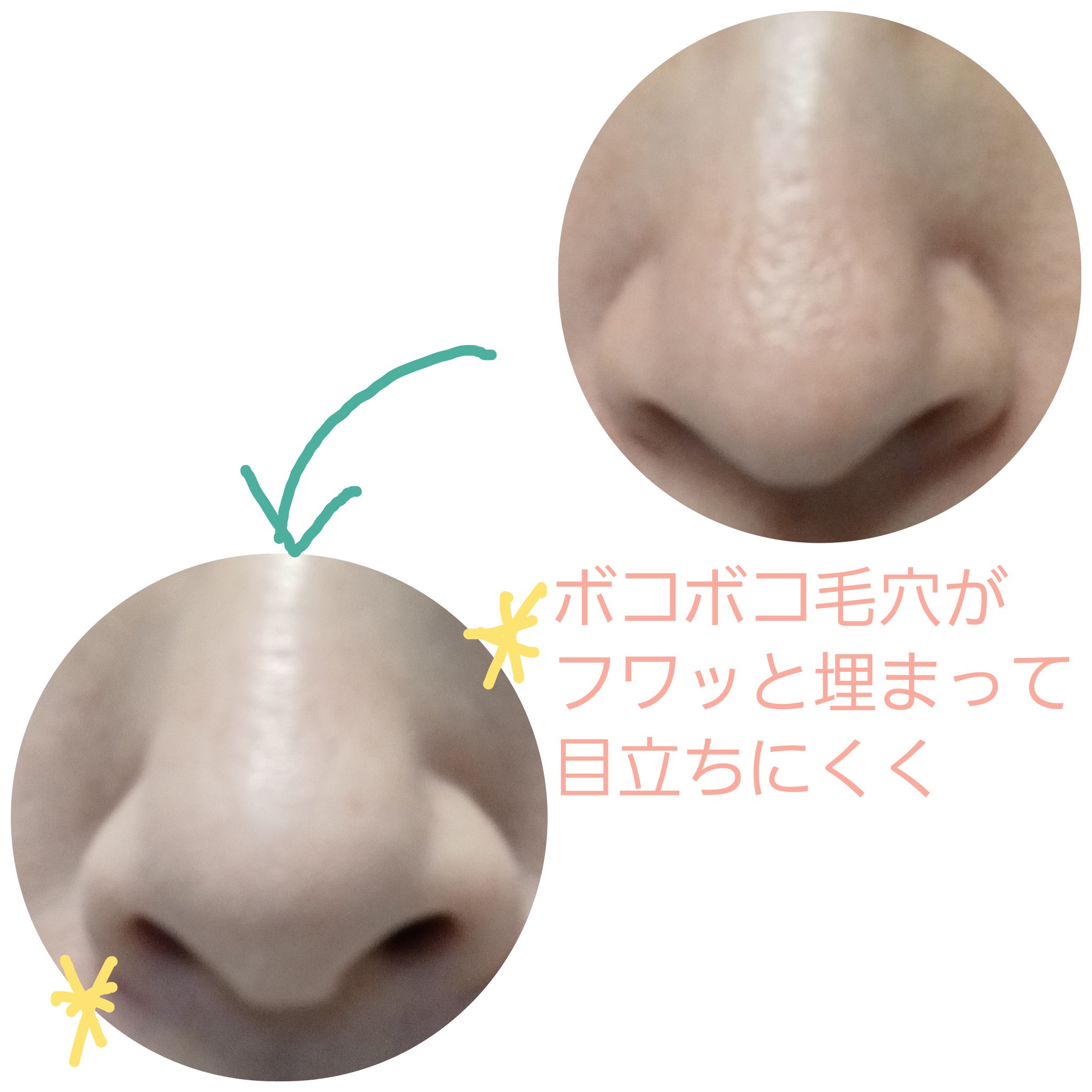 アルビオン / アンフィネス ポア コンシーラーの口コミ写真（by 冬