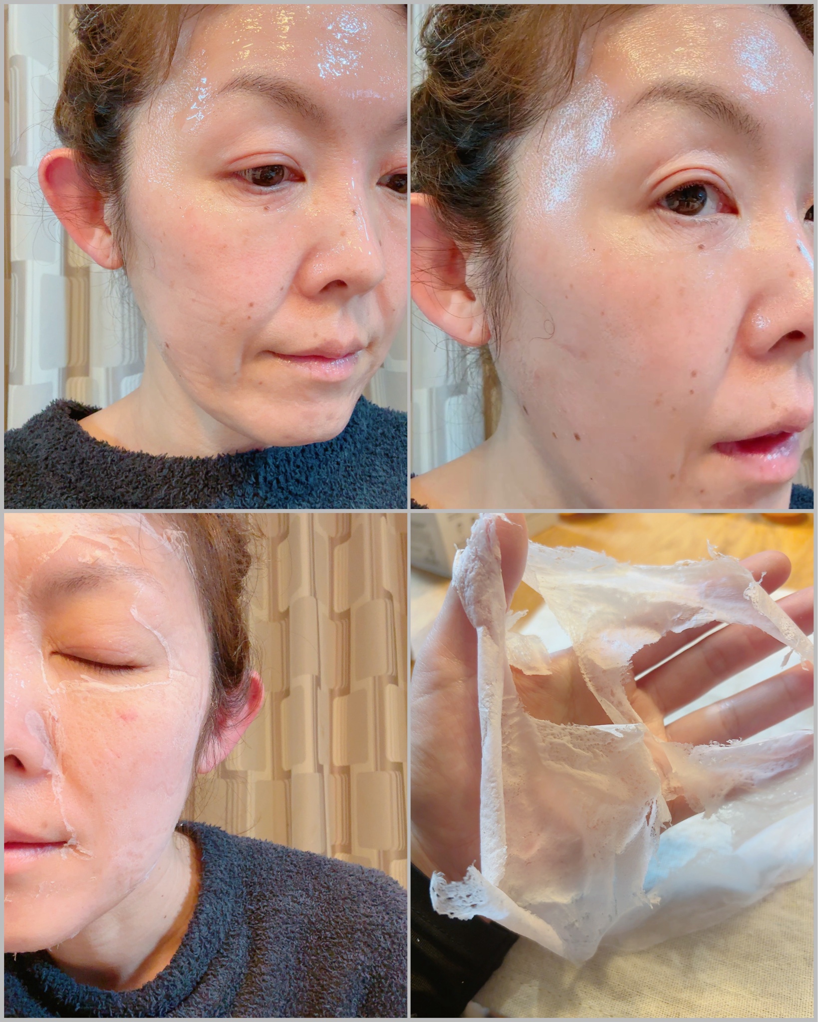 ニードルマニア / ニードルマニア ナイアシンアミドジェルパックの公式