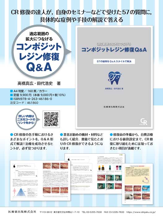 書籍詳細「コンポジット レジン修復 Q＆A」 | フォルディネット