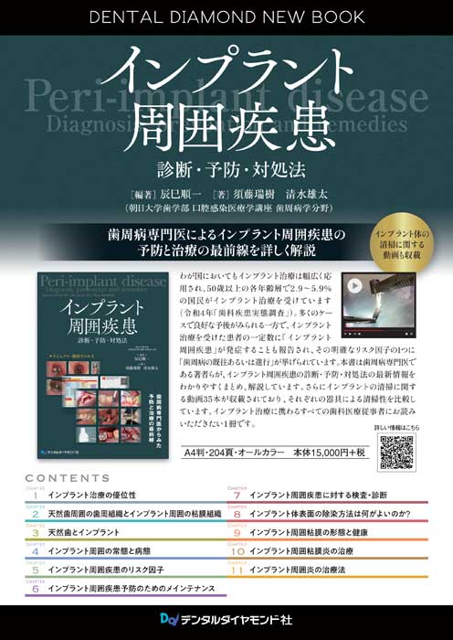 書籍詳細「パーシャルデンチャーの基本を押さえたIOD・IARPDの臨床