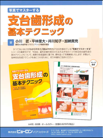 書籍詳細「支台歯形成の基本テクニック」 | フォルディネット
