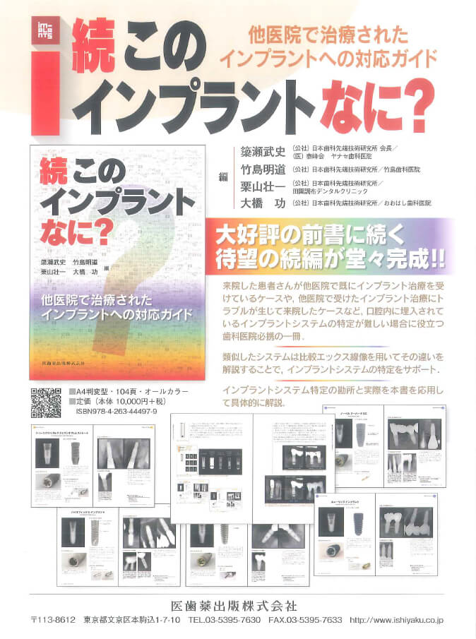 書籍詳細「続・このインプラントなに？」 | フォルディネット