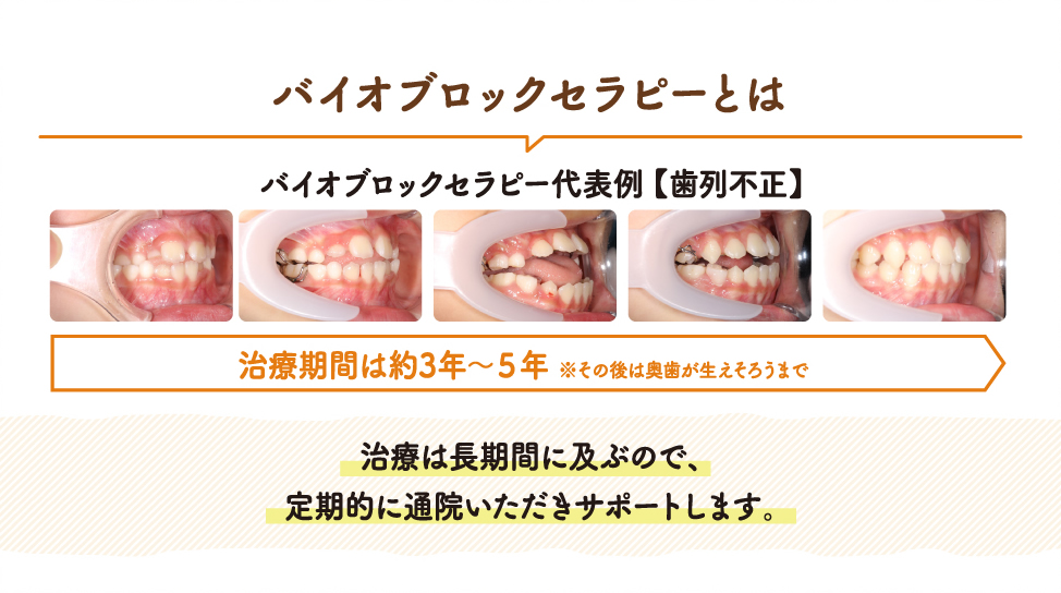 矯正について(バイオブロックセラピー) | 藤井歯科矯正歯科