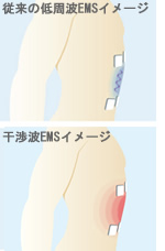 EMSでトレーニング ツインビート3ターボ