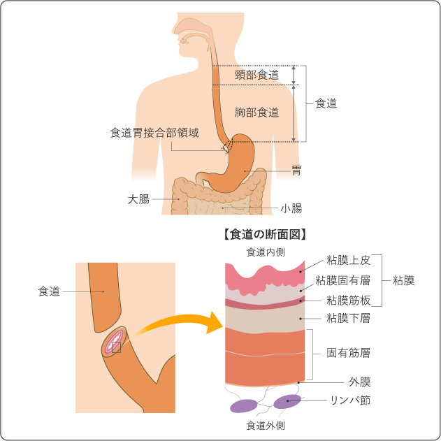 食道がん 全ページ：[国立がん研究センター がん情報サービス 一般の方へ]