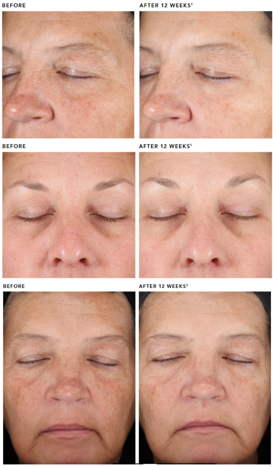 REVISION（リビジョン）:DEJ フェイスクリーム | BAOクリニック