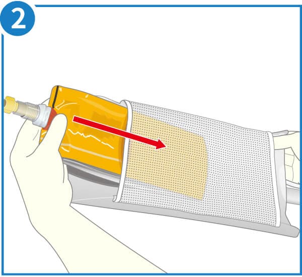 在庫限り】ニプロ EN加圧バッグCS（加圧ポンプ専用）｜ 医療用品通販