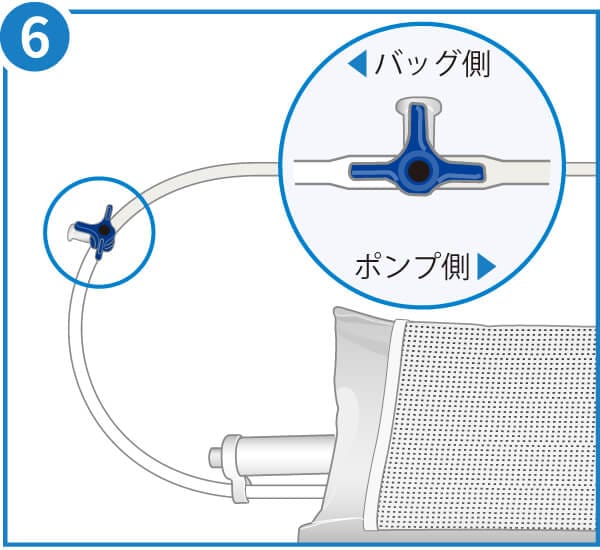在庫限り】ニプロ EN加圧バッグCS（加圧ポンプ専用）｜ 医療用品通販