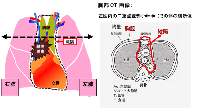 呼吸器外科 | 診療科・センター | 診療科・部門 | 浜の町病院
