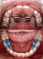 顎顔面矯正/矯正歯科｜御茶ノ水・小川町の歯医者 | 塚原デンタルクリニック