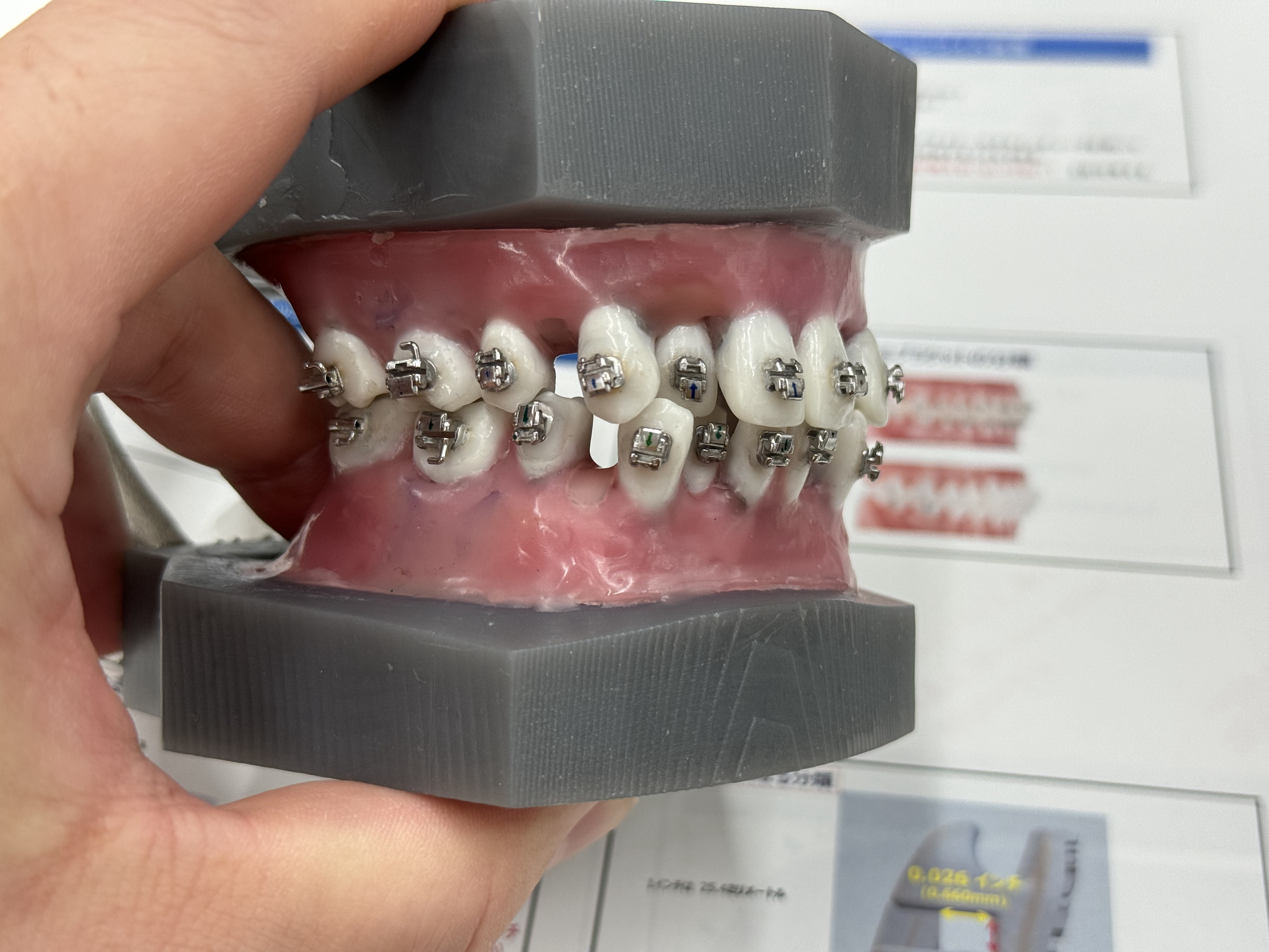 矯正セミナーに行ってきましたin兵庫〜タイポドント実習〜 - 医療法人