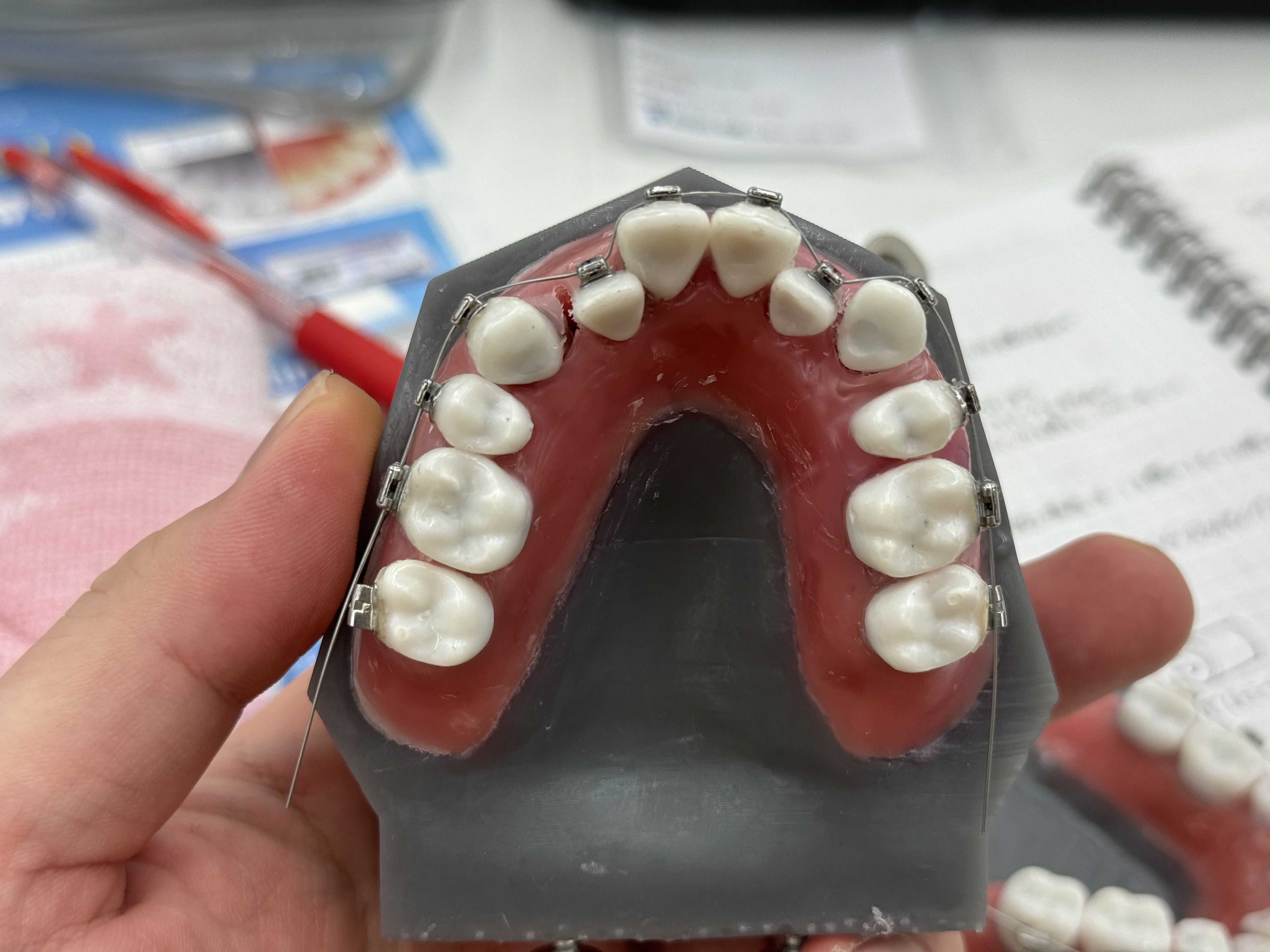 矯正セミナーに行ってきましたin兵庫〜タイポドント実習〜③ - 医療