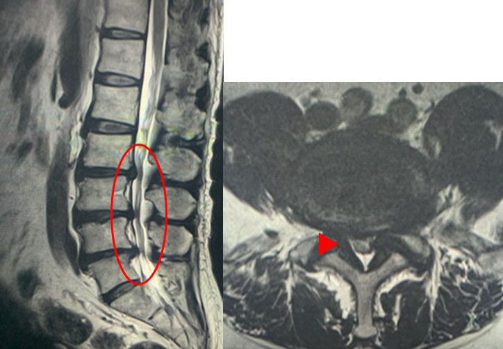 脊椎脊髄センター｜手術治療｜順天堂大学医学部附属順天堂医院