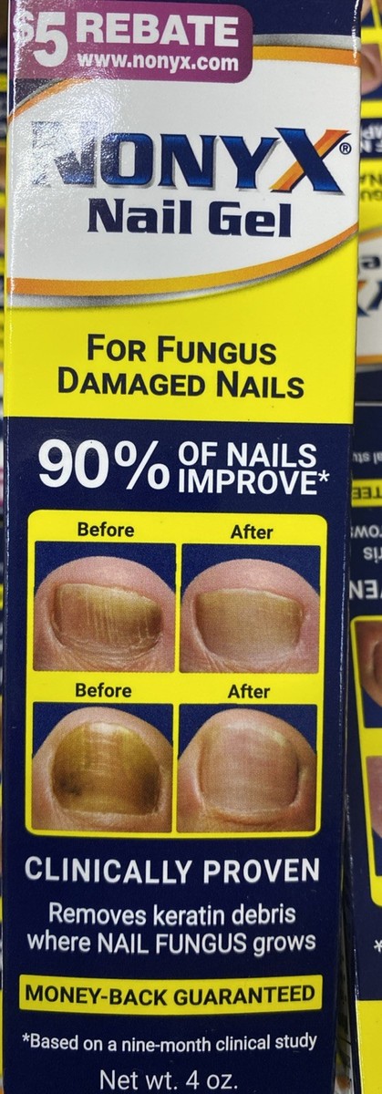 Nonyx Fungal Nail Gel Clarifying by Xenna 4 oz Exp 12/2028 | eBay