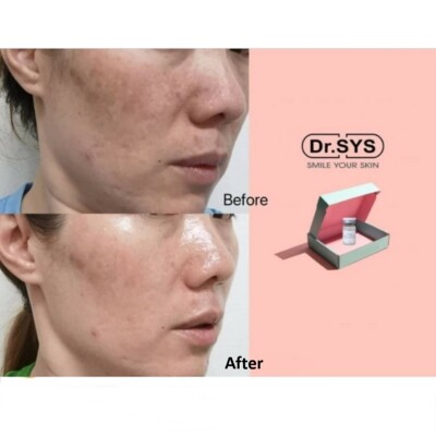 DR.SYS PS CELL AMPOULE OSMOCELL STEM CELL CALMING WRINKLE-REDUCING