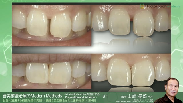 世界に通用する補綴治療の実践 ～機能と美を融合させた歯科治療～ 第4