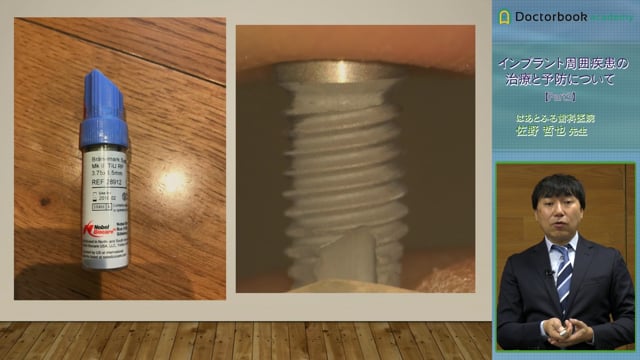 インプラント周囲疾患の治療と予防について | Doctorbook academy