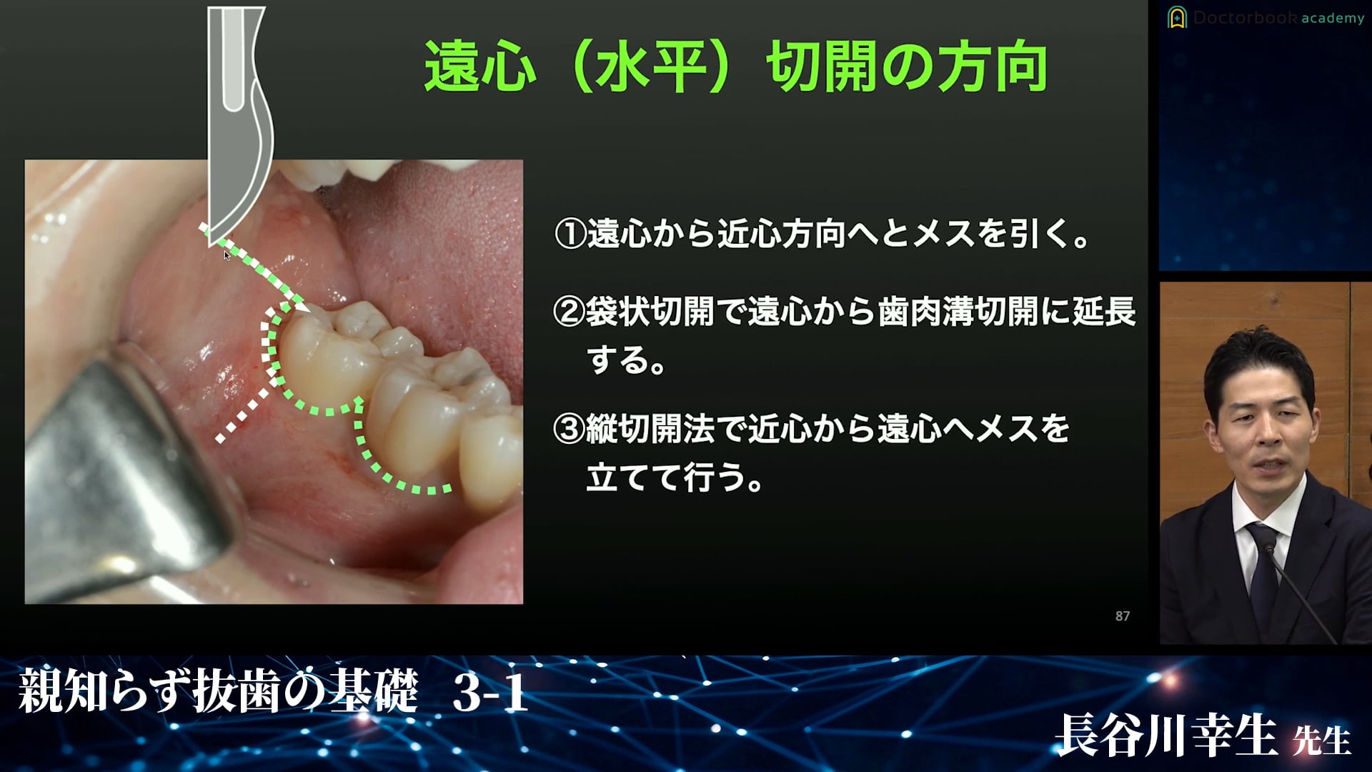 歯肉切開・剥離の手技│完全版！埋伏抜歯のバイブル 3-1 | Doctorbook