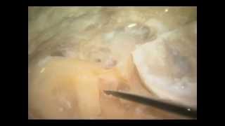 中耳・側頭骨3D解剖マニュアル[DVD-ROM付] | 書籍詳細 | 書籍 | 医学書院