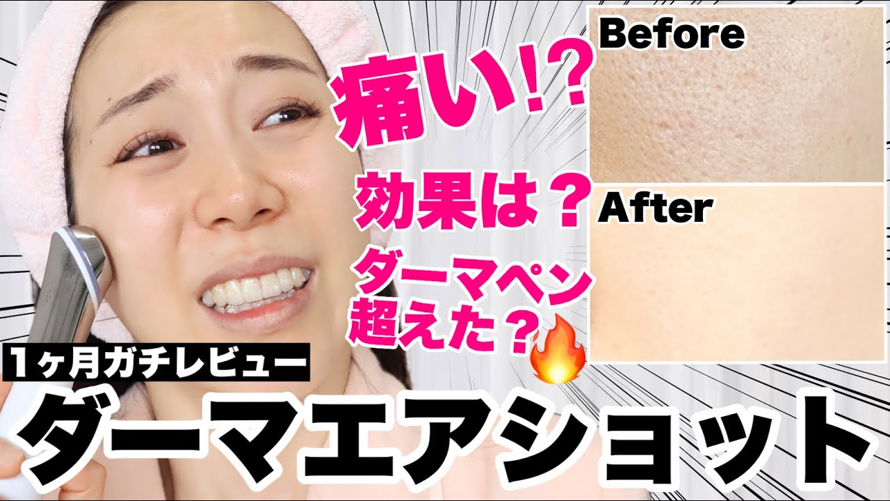 毛穴引き締めダーマペン美顔器「ダーマエアショット」5分使用ガイド