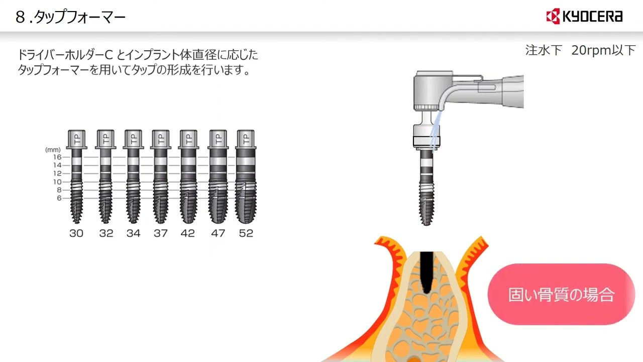 カタログ・マニュアル｜FINESIA（ファインシア）｜京セラメディカル