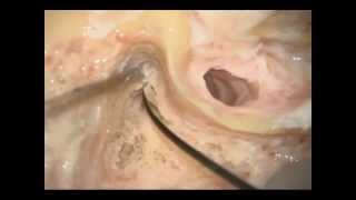 中耳・側頭骨3D解剖マニュアル[DVD-ROM付] | 書籍詳細 | 書籍 | 医学書院