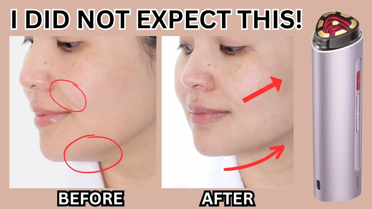 Transform Your Jawline in Minutes! | AMIRO R3 Turbo Facial Review