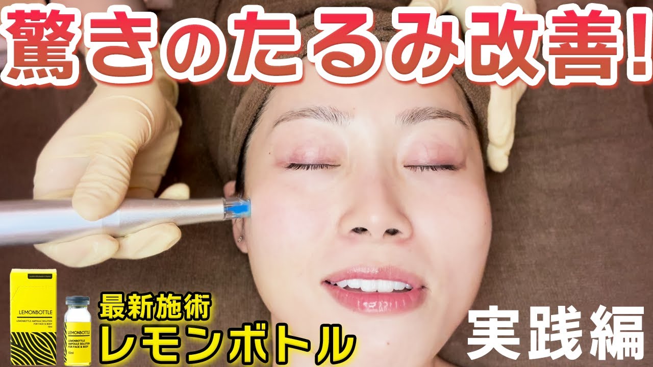 ALOHA レモンボトル、高純度リジュラン、脂燃パッチ Fat-dissolving